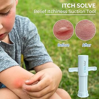 Experience Instant Relief -Ultimate Bite & Sting Relief Tool - For Itch-Less, Comfortable Days!