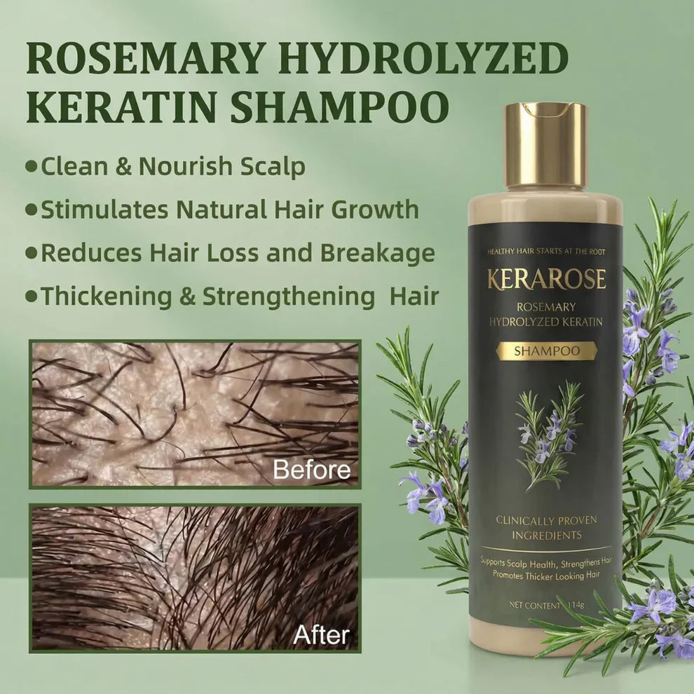 Kerarose Rosemary Shampoo For Hair Growth ( Buy 1 Get 1 Free 🔥)