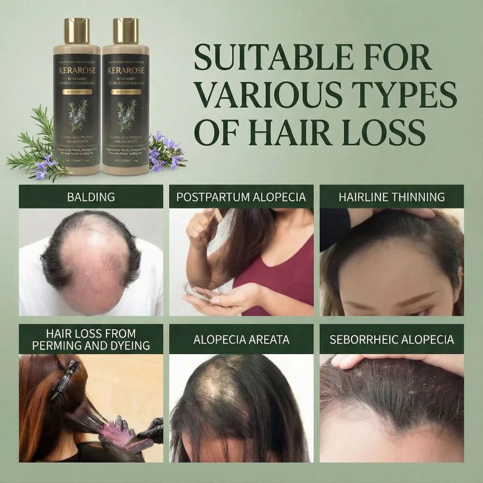 Kerarose Rosemary Shampoo For Hair Growth ( Buy 1 Get 1 Free 🔥)