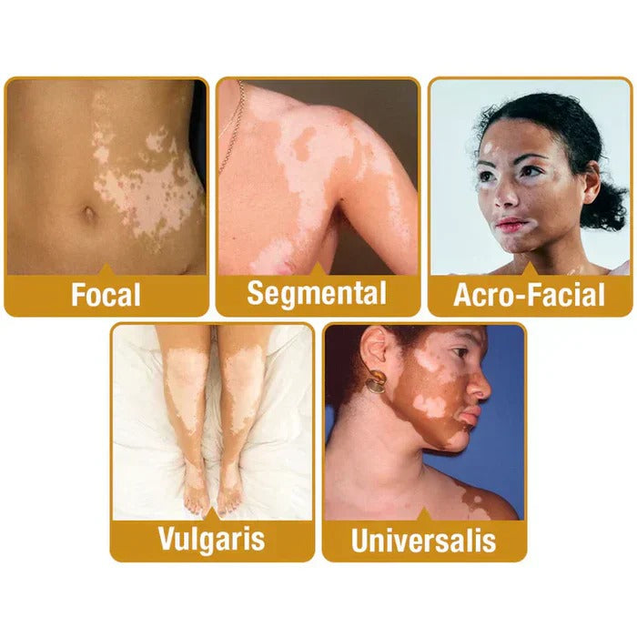 VitiGO™ Revitalizing Bee Venom Cream | Natural Skin Restoration & Vitality