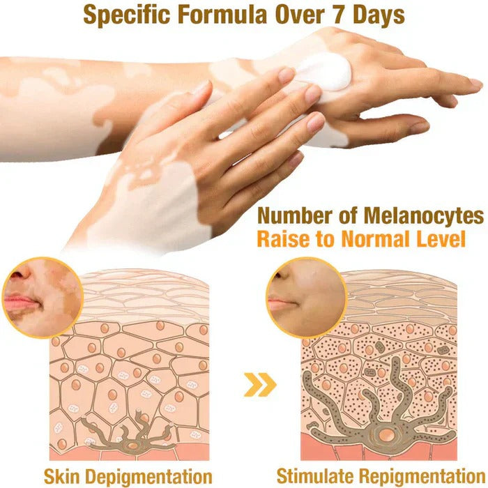 VitiGO™ Revitalizing Bee Venom Cream | Natural Skin Restoration & Vitality